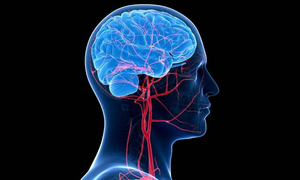 What’s the connection between diabetes and stroke? What’s the connection between diabetes and stroke?