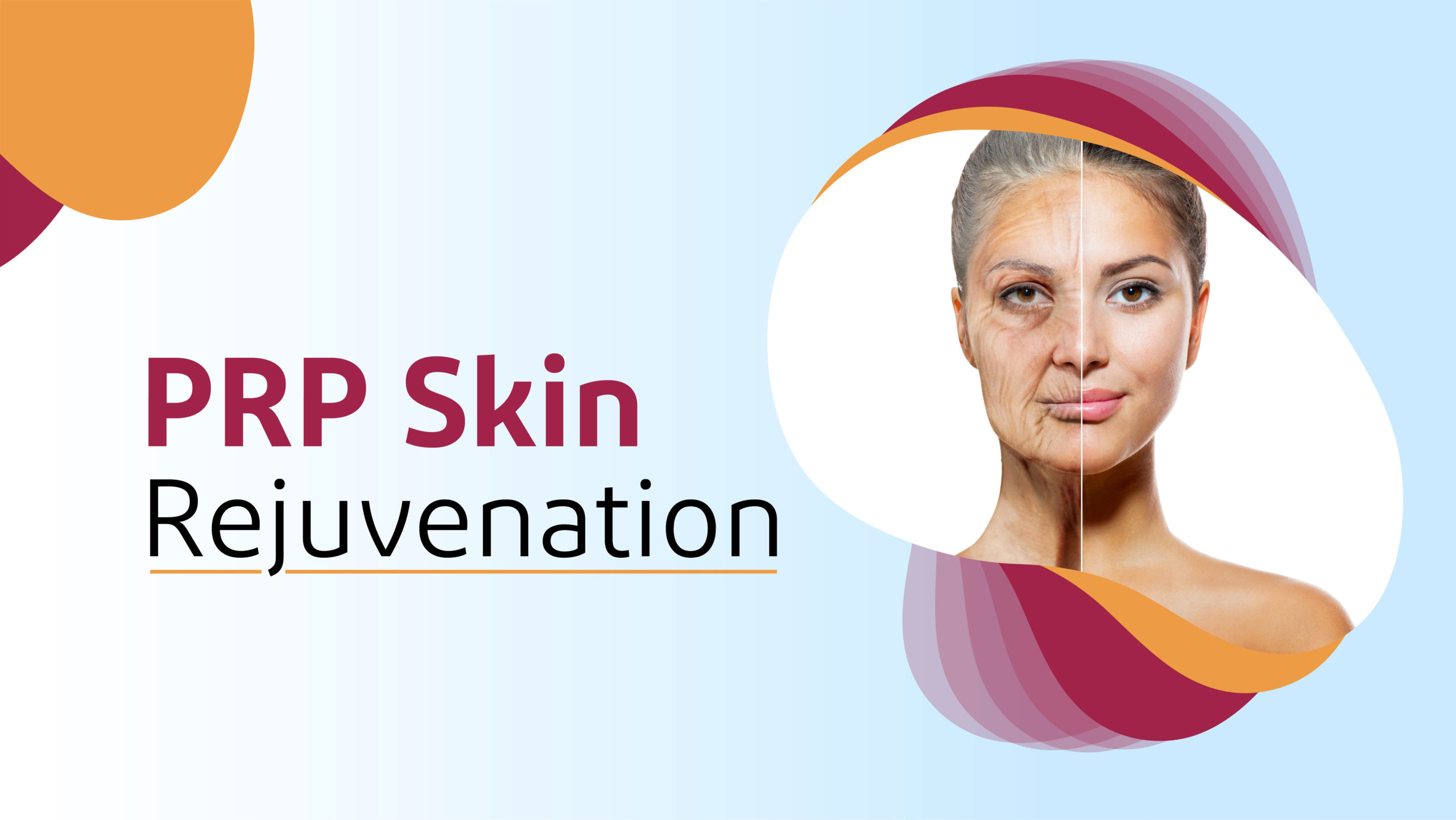 PRP SKIN REJUVENATION TREATMENT