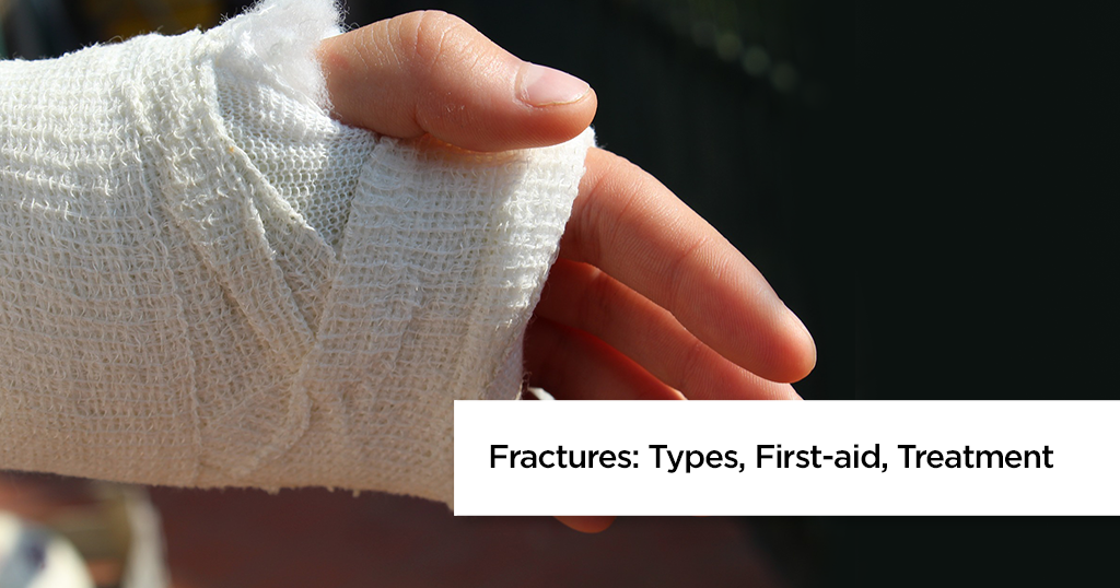 Types of Fractures &amp; First Aid Treatment