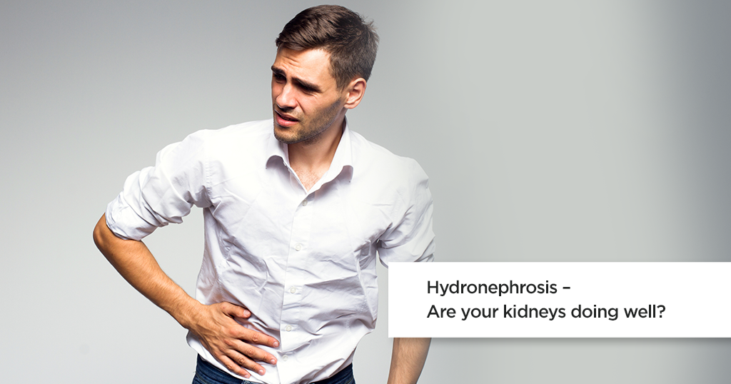Hydronephrosis : Symptoms, Causes &amp; Treatment