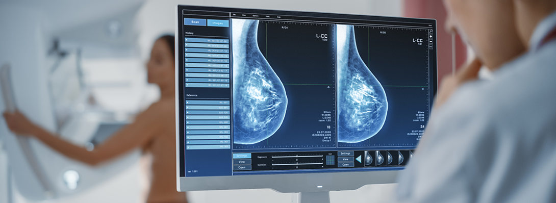 5 Breakthroughs in Breast Cancer Treatments