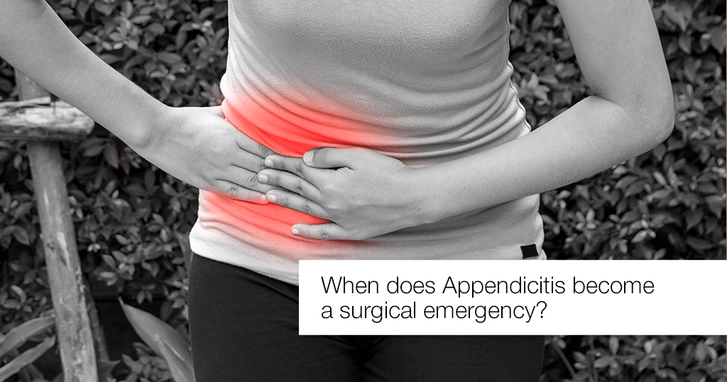 All About Appendicitis