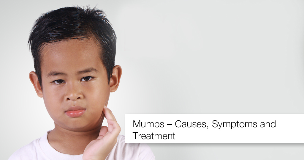 Mumps – Causes, Symptoms and Treatment