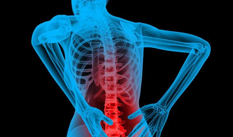 Back Pain (Lower and Upper) : Symptoms, Causes, Treatment, Diagnosis and Prevention Back Pain (Lower and Upper) : Symptoms, Causes, Treatment, Diagnosis and Prevention