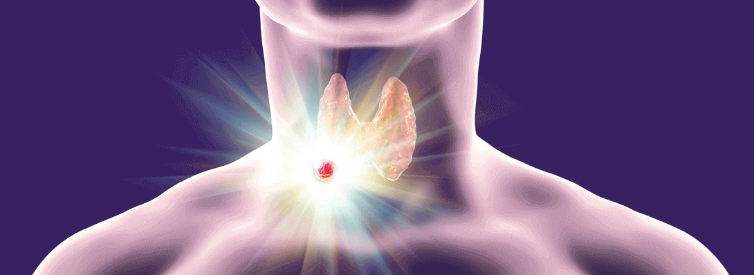 Thyroid Cancer: Is Surgery the Only Solution?