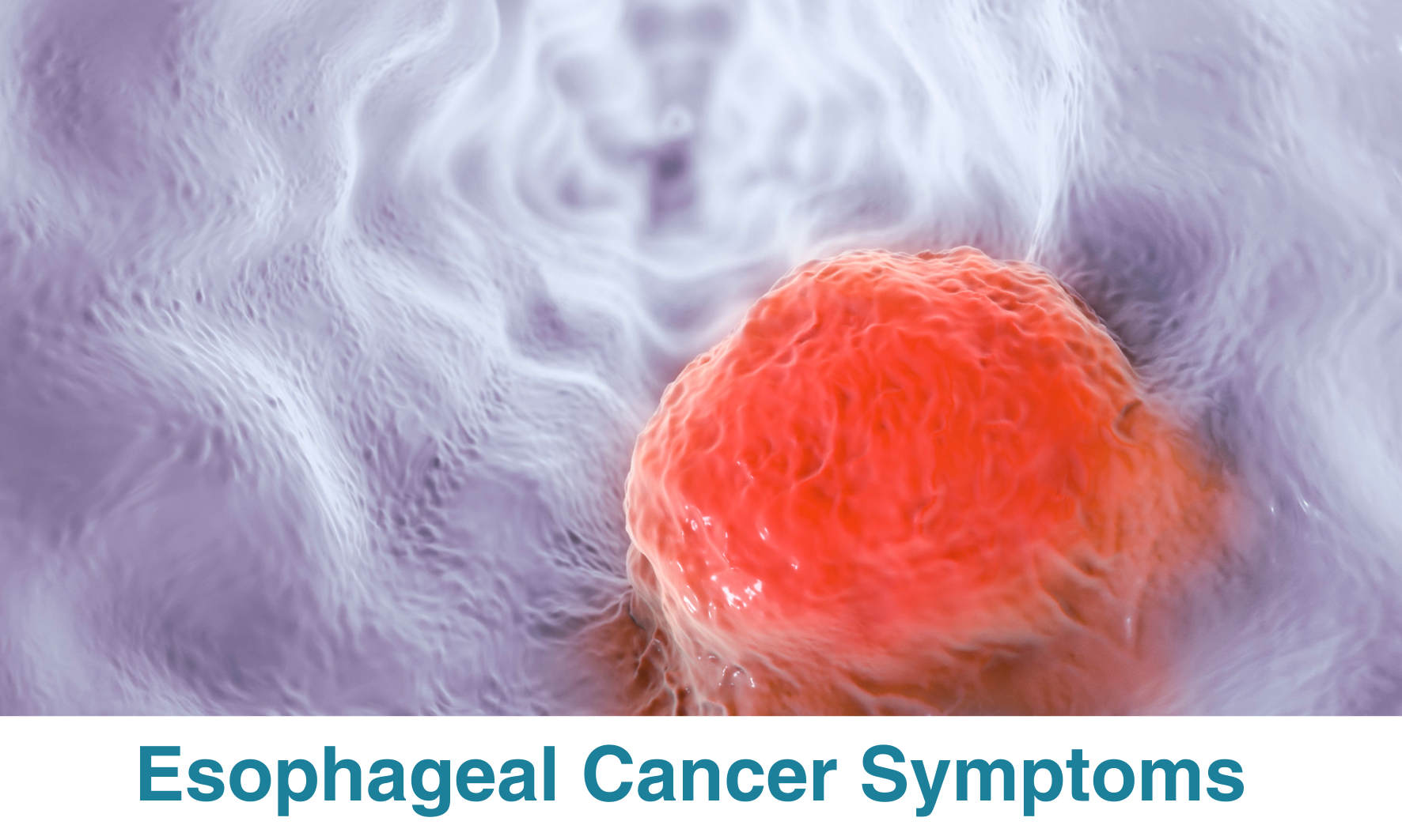 Esophageal Cancer Symptoms