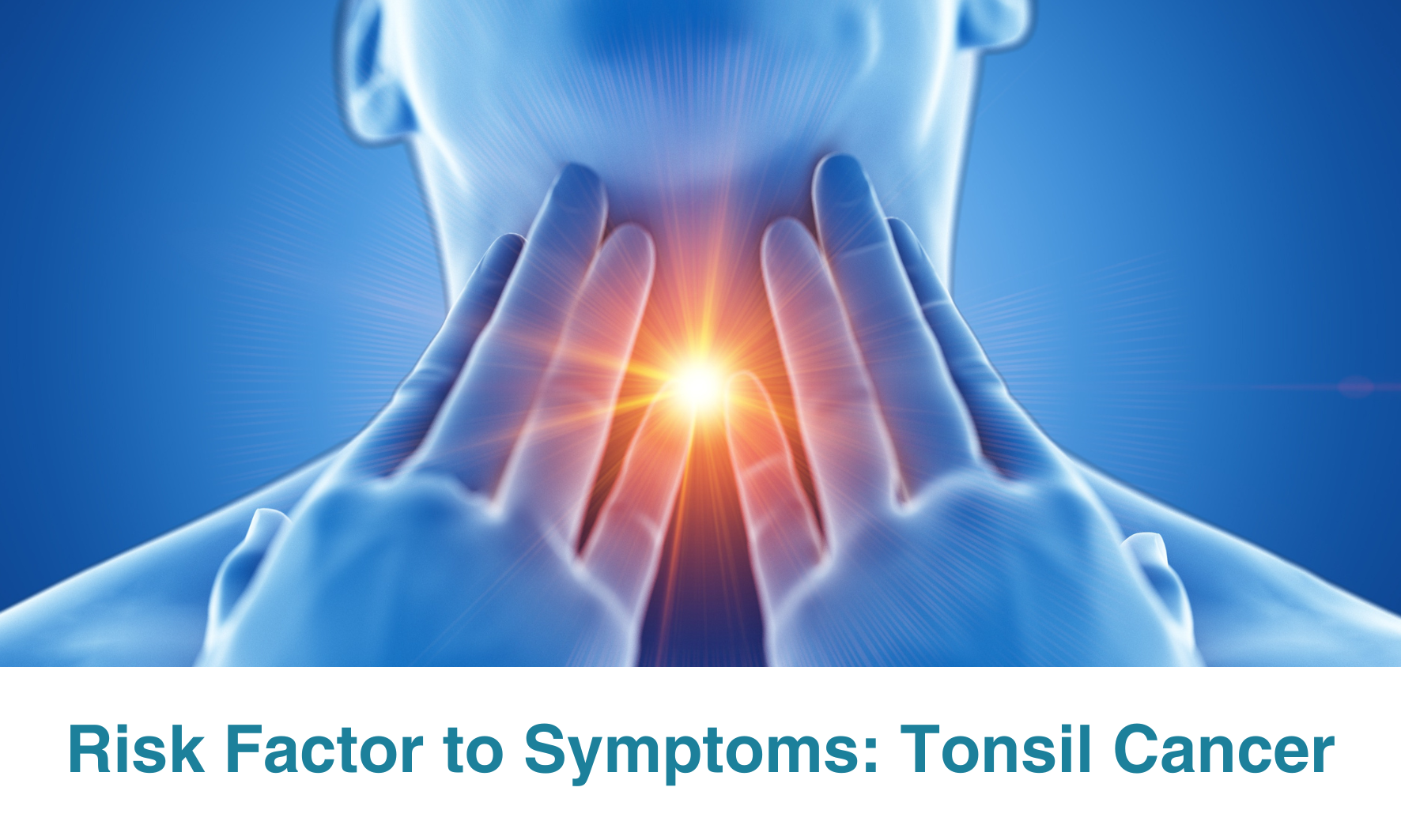 From Risk Factors to Symptoms: A Comprehensive Guide to Tonsil Cancer