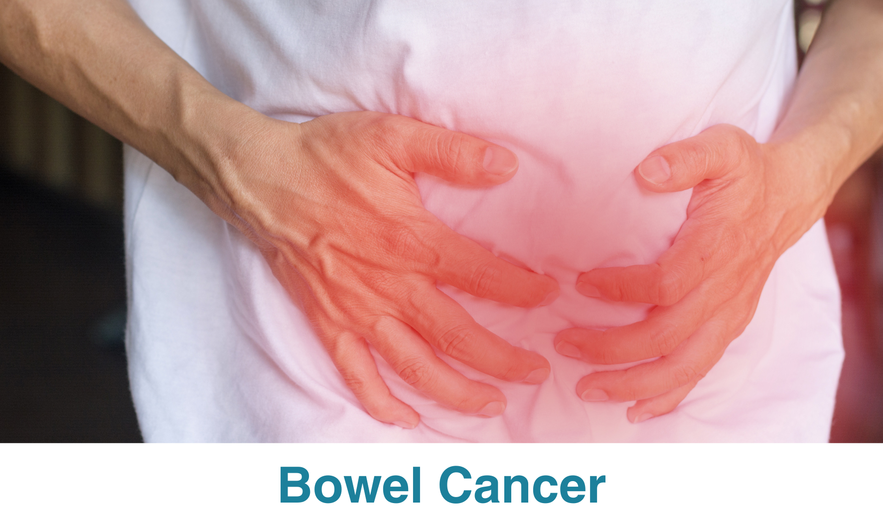 Bowel Cancer