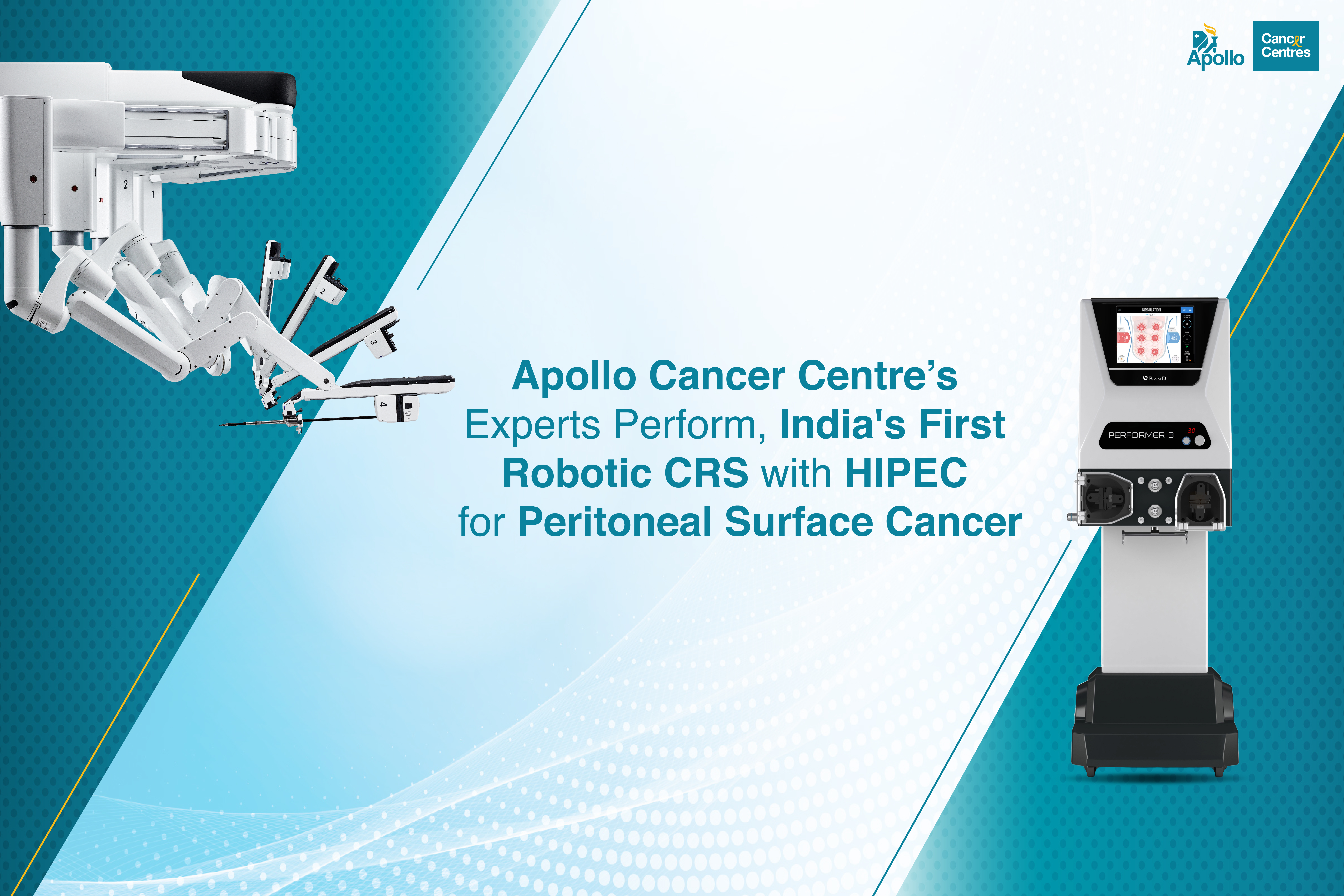 Apollo Cancer Centre’s Experts Perform, India’s First Robotic CRS with HIPEC for Peritoneal Surface Cancer