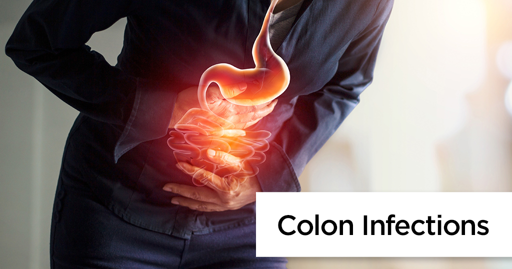 All About Colon Infection
