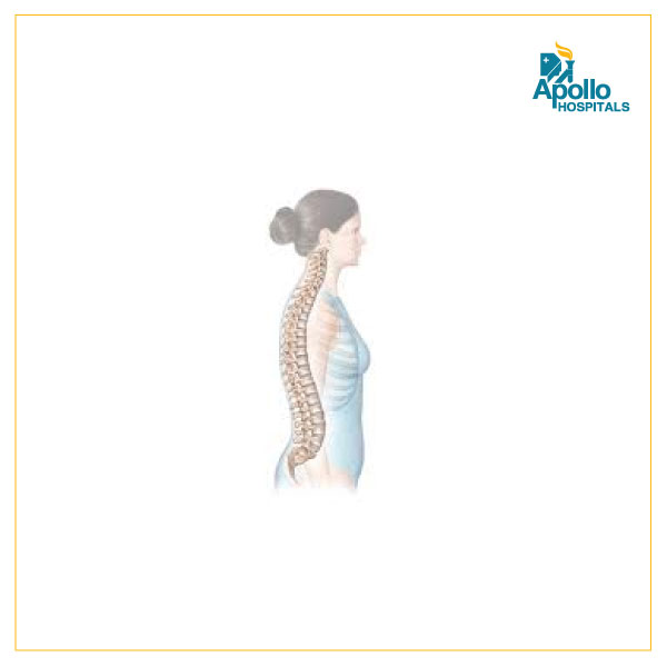 Spine Surgery – Introduction