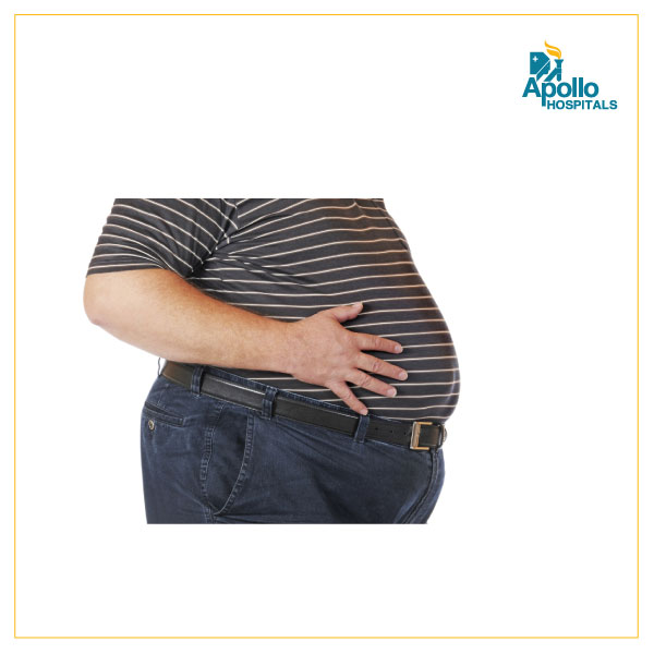 Diabetes – Obesity & Bariatric Surgery