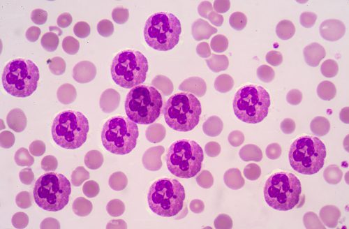 What causes blood in urine?