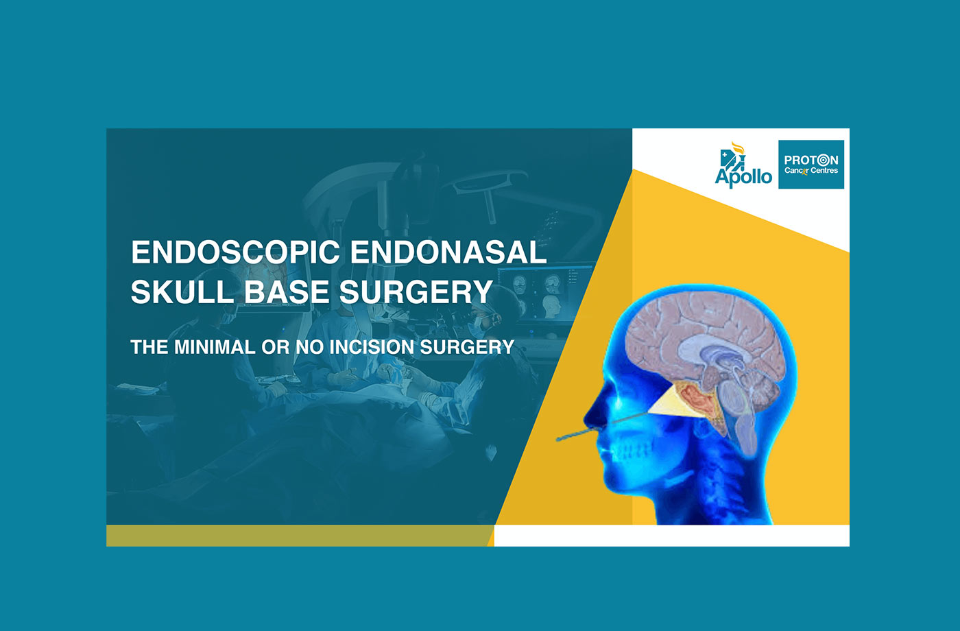 Endoscopic Endonasal Skull Base Surgery Explained