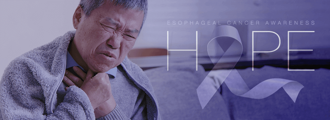 Early Detection of Esophageal Cancer and the Importance of Screening and Testing