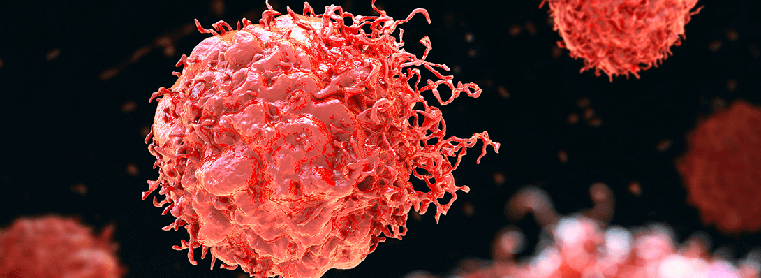 Genetic Factors and Gastrointestinal Stromal Tumors: What You Need to Know