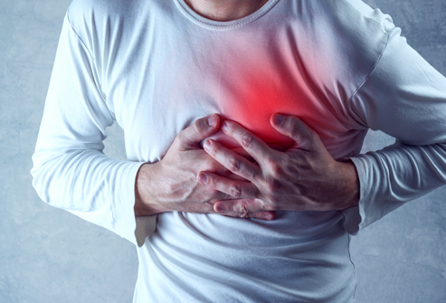What’s the Difference between a Heart Attack, a Cardiac Arrest, and a Myocardial Infarction?