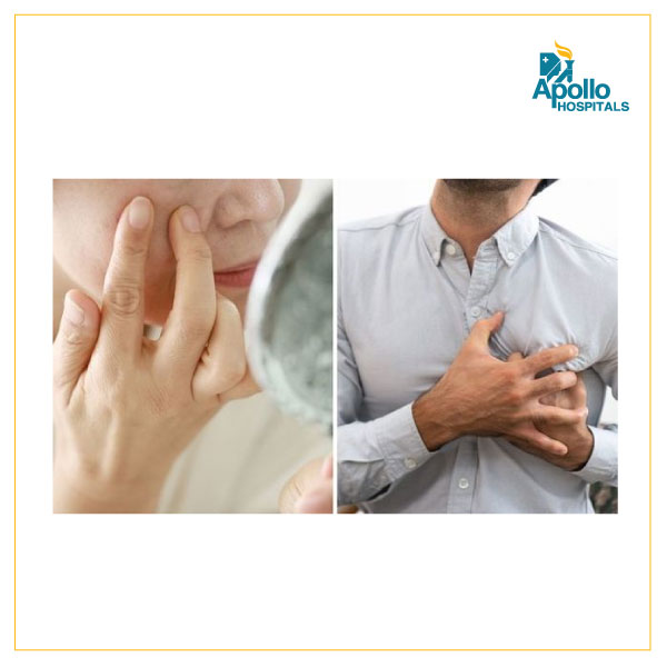 Unusual signs of a heart attack