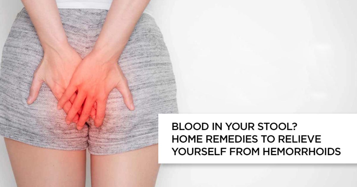 Blood in your stool? Home Remedies to Relieve Yourself from Hemorrhoids