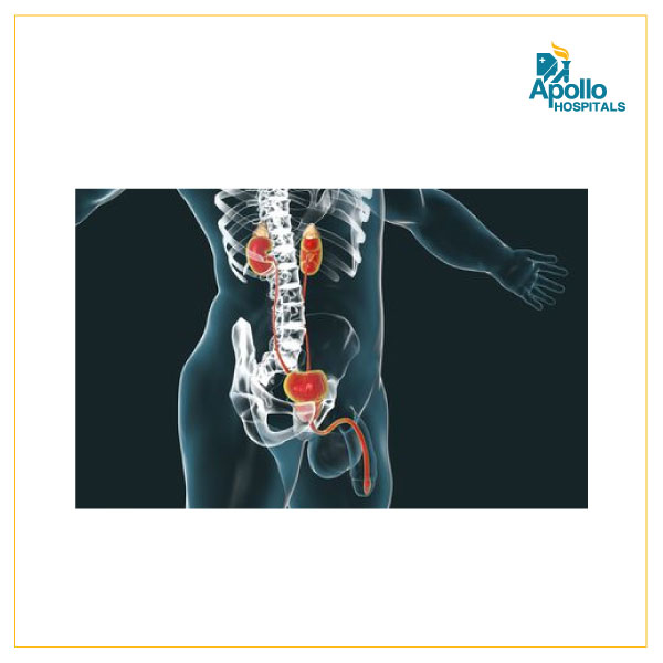 Hypospadias Explained: A Complete Guide