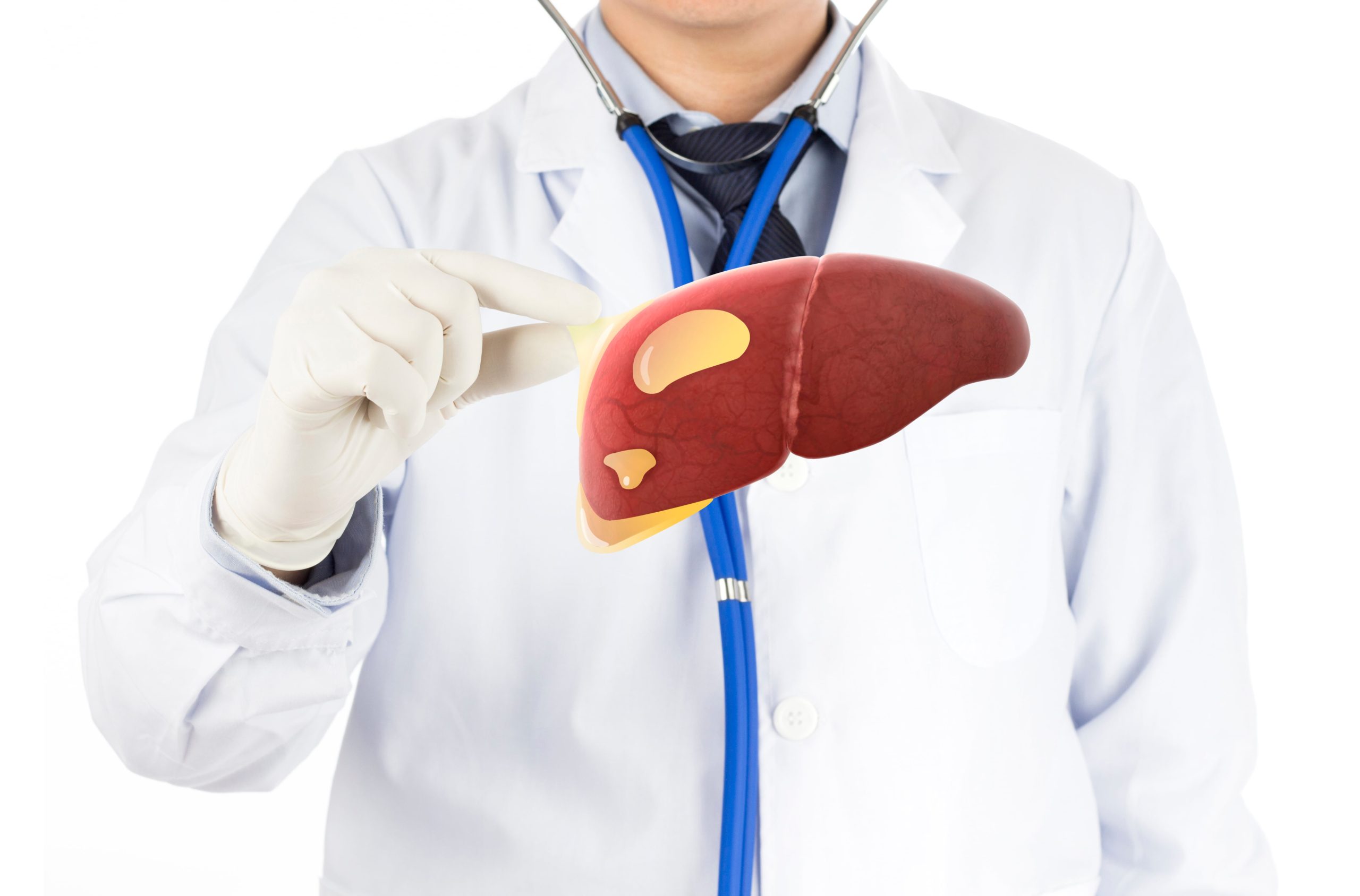 Liver Cysts: Types, Symptoms, Causes, Diagnosed &amp; Treax`tment