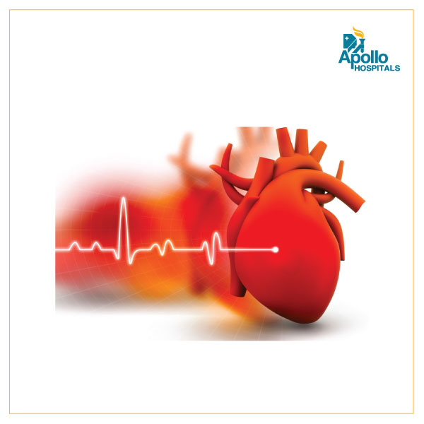 Abnormal Heart Rhythms – Symptoms & Treatment