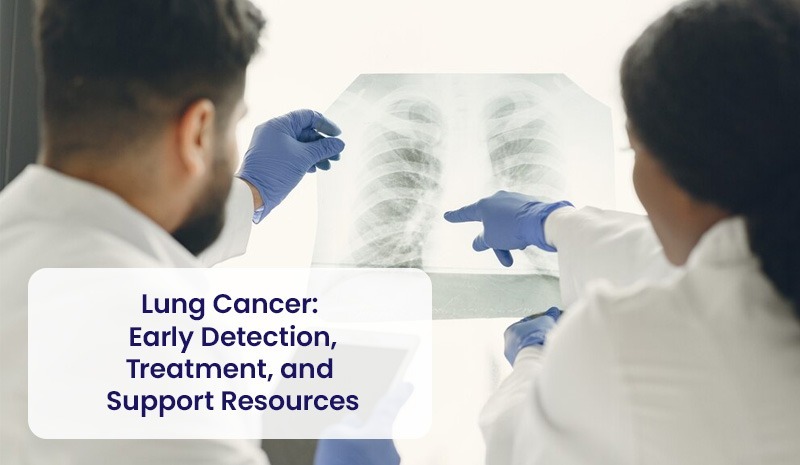 Lung Cancer: Early Detection, Treatment, and Support Resources
