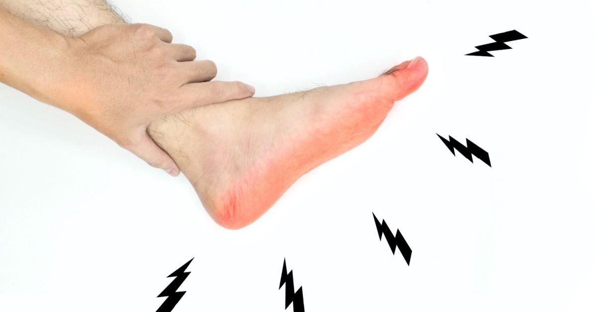 Multifocal Motor Neuropathy: Causes, Symptoms, Treatment &amp; Effects