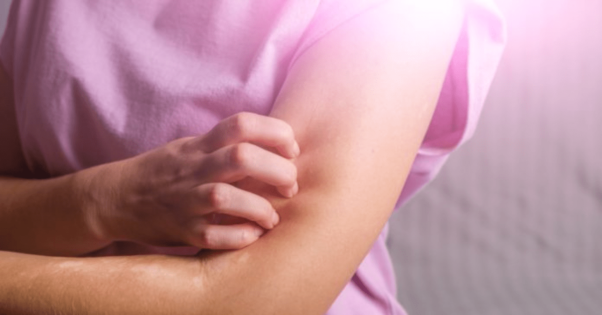 Neurodermatitis – Symptoms and Causes, Diagnosis and Treatment