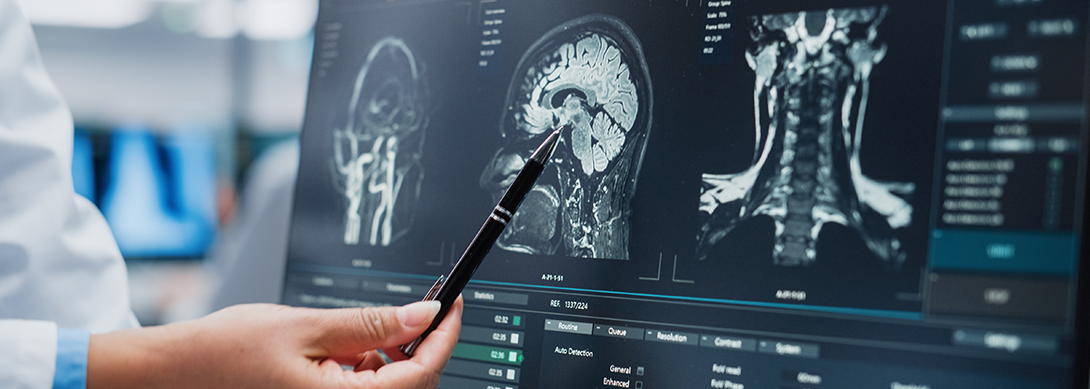 Role of Neurosurgery in the Treatment of Traumatic Brain Injuries