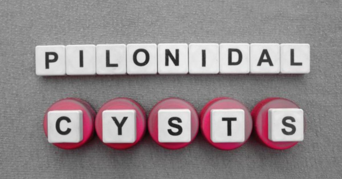 Pilonidal Cysts – Symptoms, Diagnosis, Risk Factors and Treatment