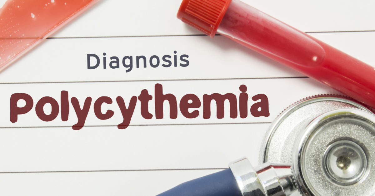 Polycythemia Vera: Causes, Symptoms and Treatments