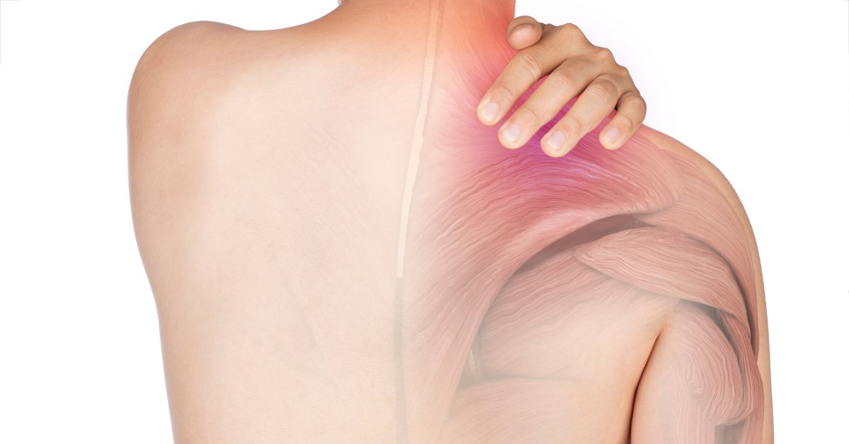 Polymyositis – Diagnosis, Treatment and Symptoms