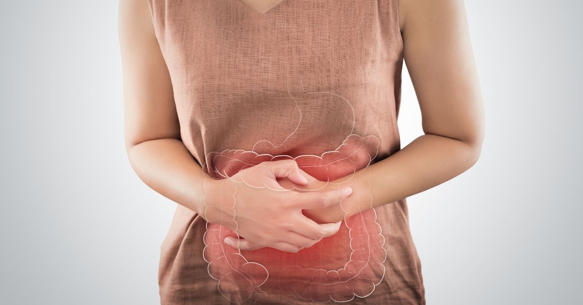 Radiation Enteritis &#8211; Symptoms, Causes And Treatment