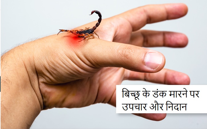 बिच्छू के डंक मारने पर उपचार और निदान