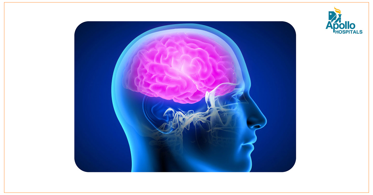 Stroke Awareness Everyone MUST Know