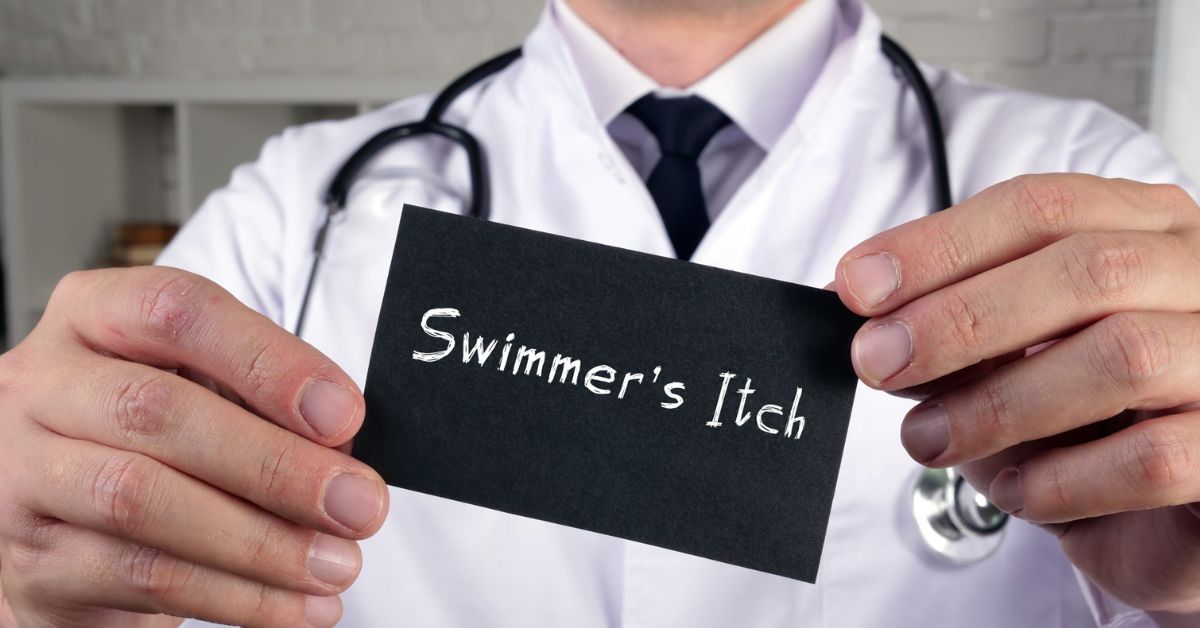Swimmer’s Itch – Causes, Symptoms and Treatment