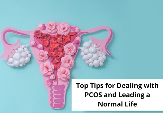 PCOS (Polycystic Ovary Syndrome) – Symptoms, Causes, Treatment, and Lifestyle Tips