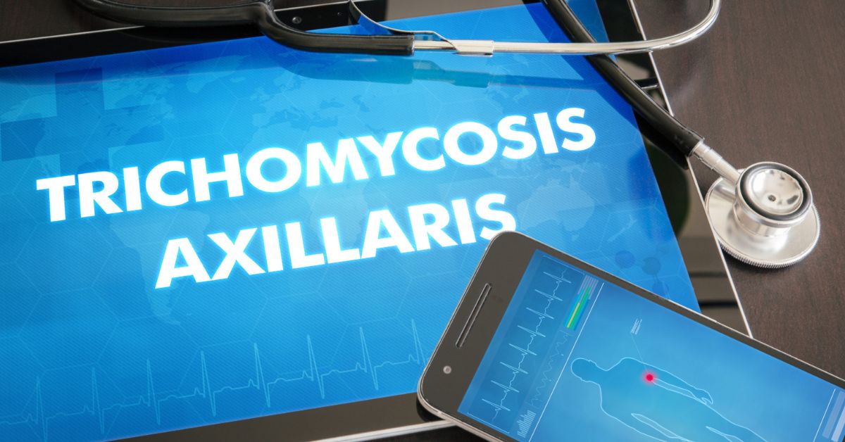 What Is Trichomycosis? – Causes, Symptoms and Treatment