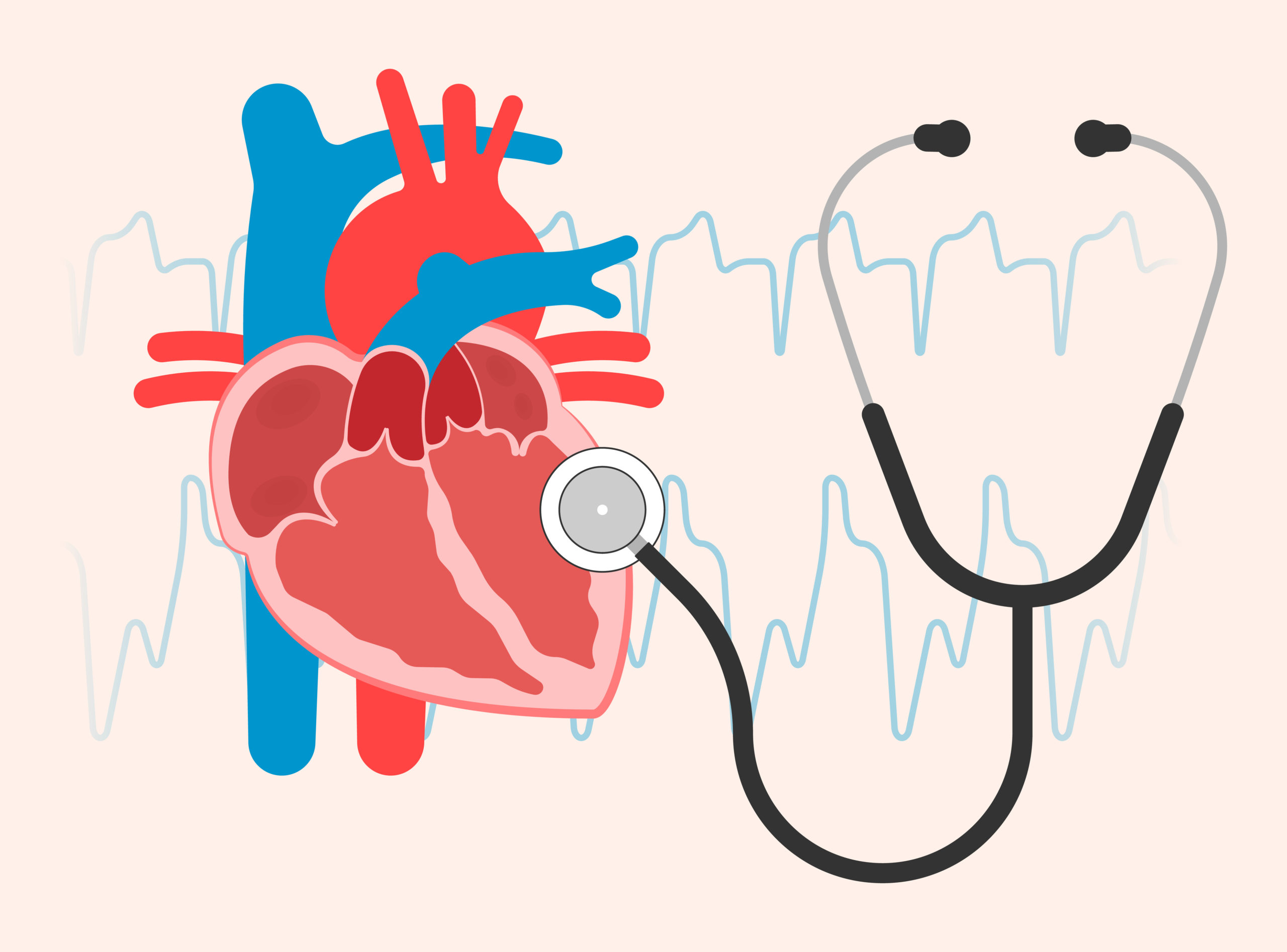 Truncus Arteriosus: Possible Causes and Treatment Options