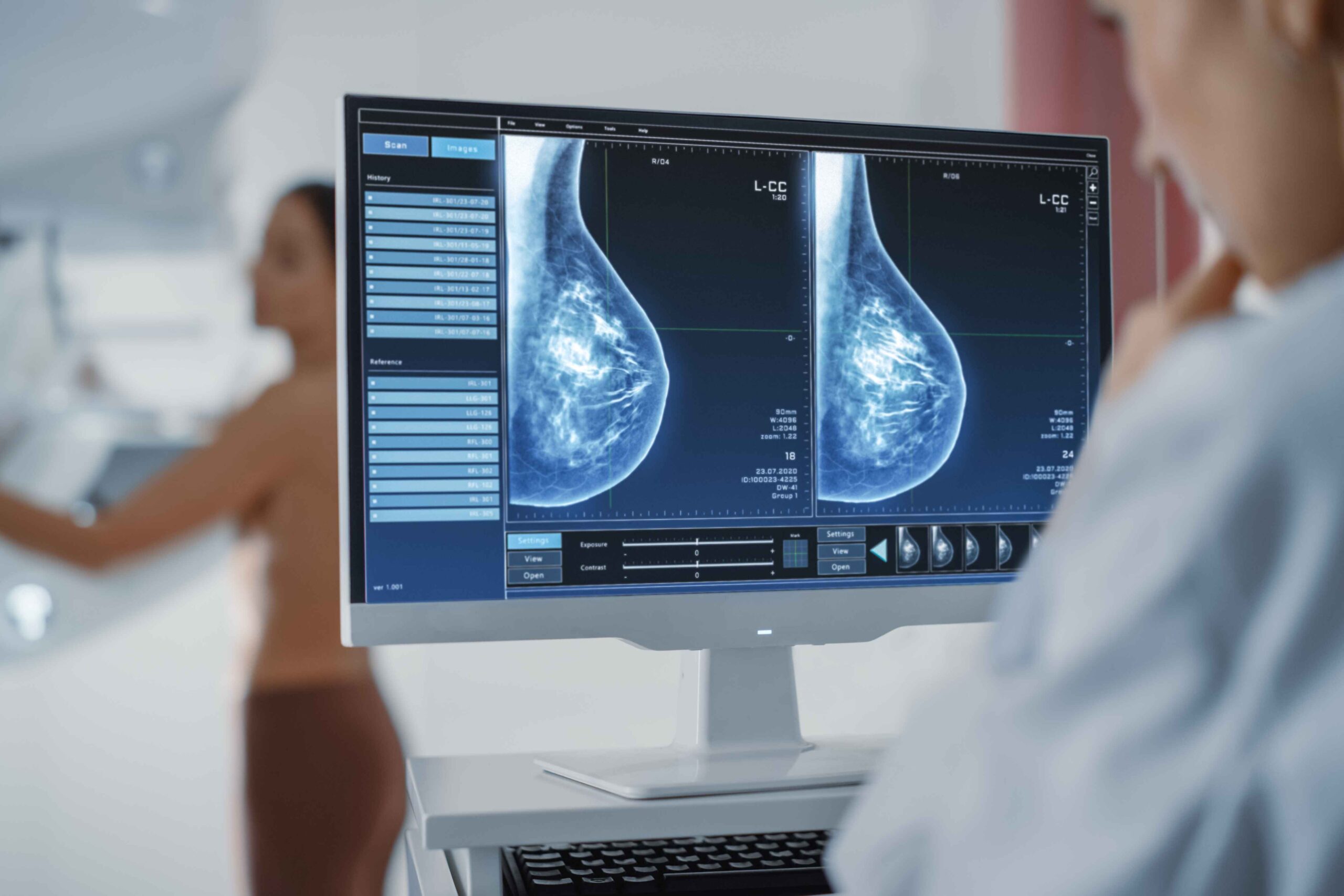 Types of Mammograms: Screening and Diagnostic