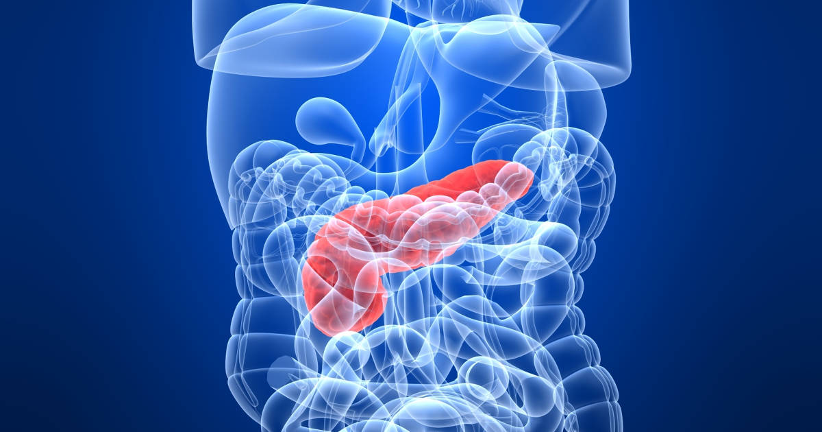 Understanding-the-Stages-of-Pancreatic-Cancer-and-Why-They-Matter