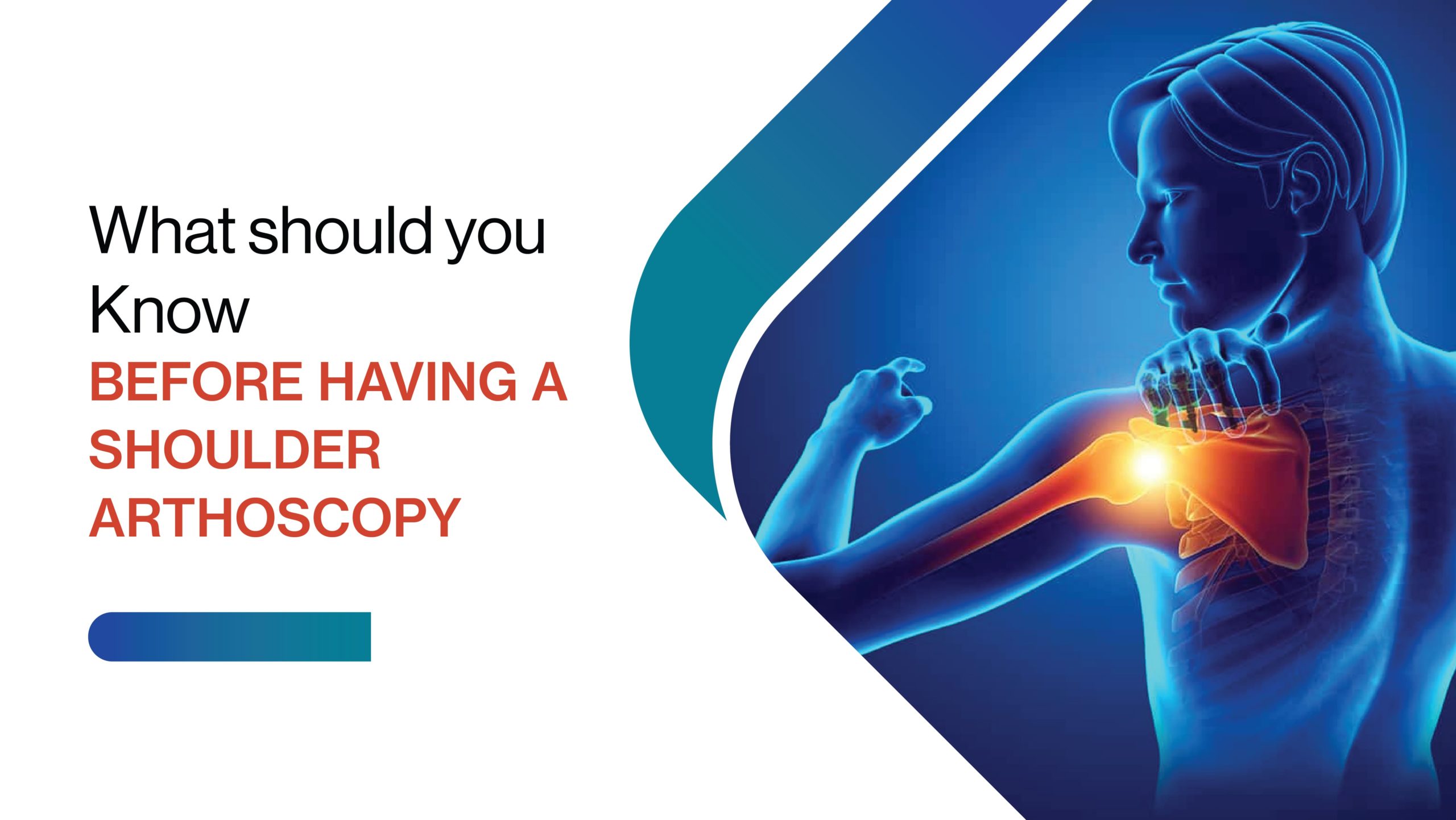 What Should You Know Before Having a Shoulder Arthroscopy?
