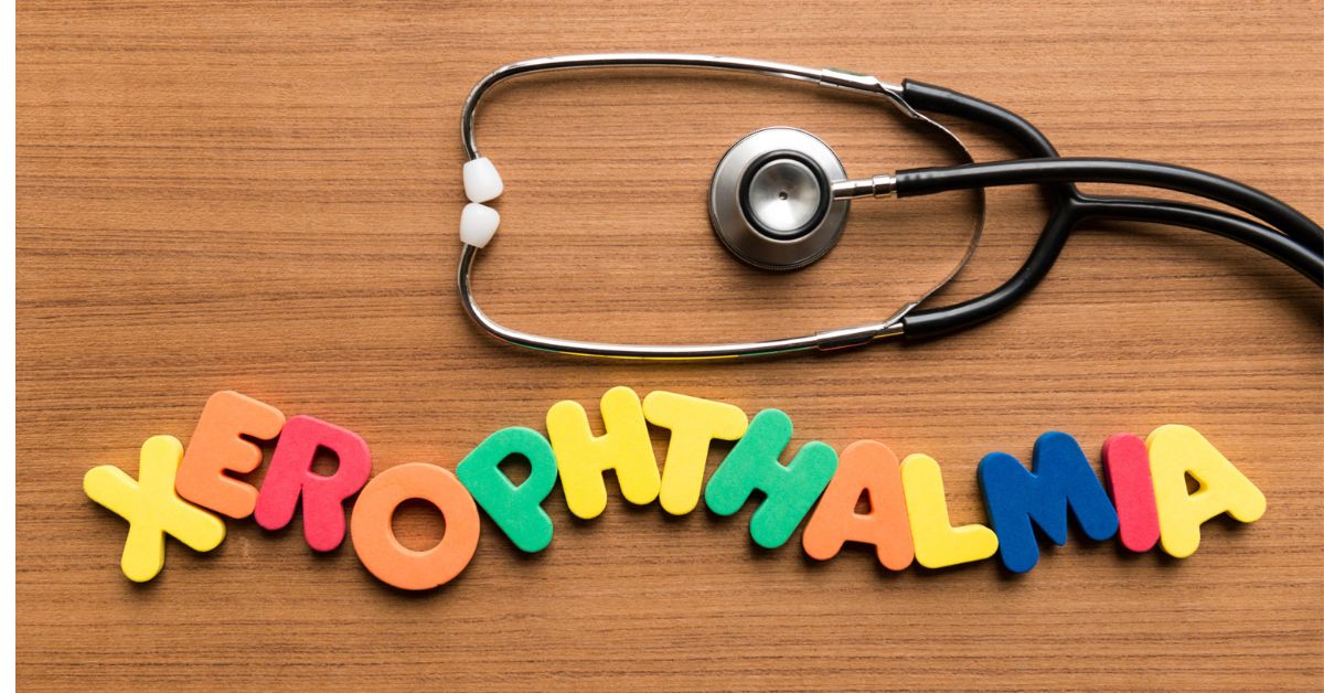Xerophthalmia &#8211; Causes, Symptoms, Risk Factors and Treatment