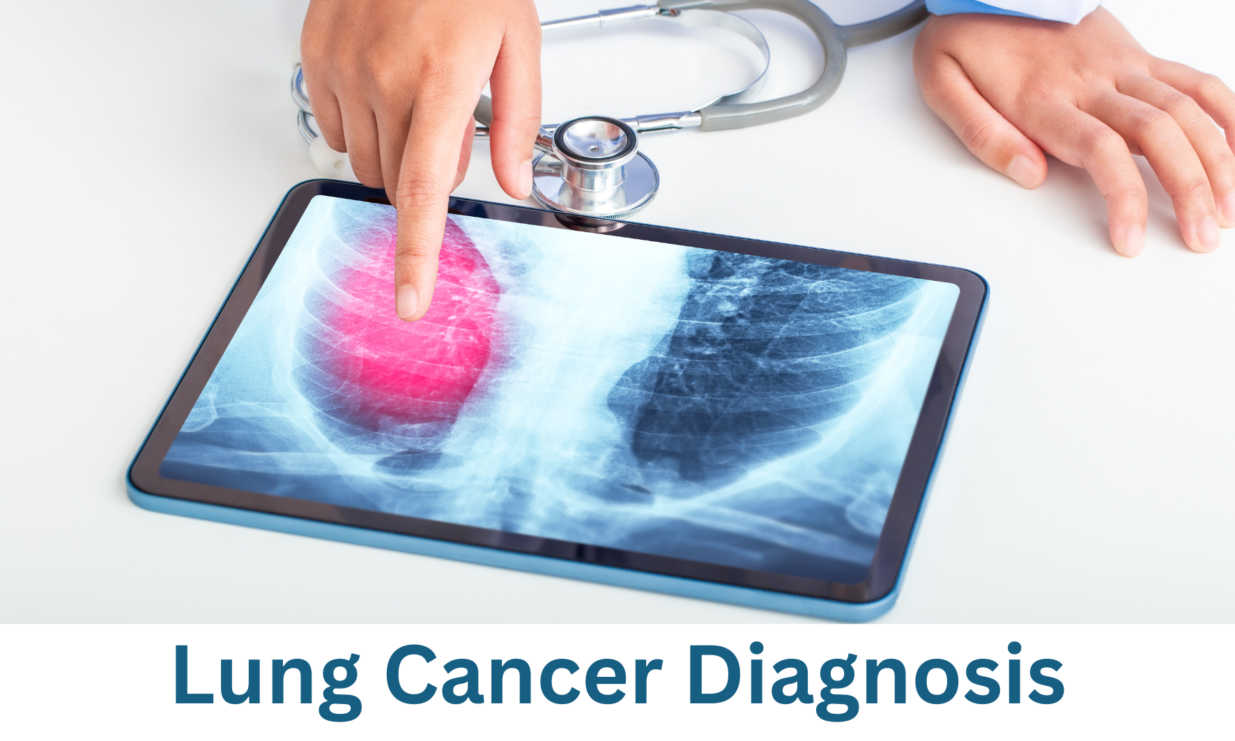 Lung Cancer Diagnosis