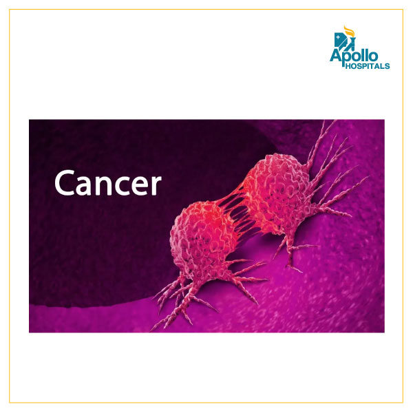 5 Warning signs of mouth cancer