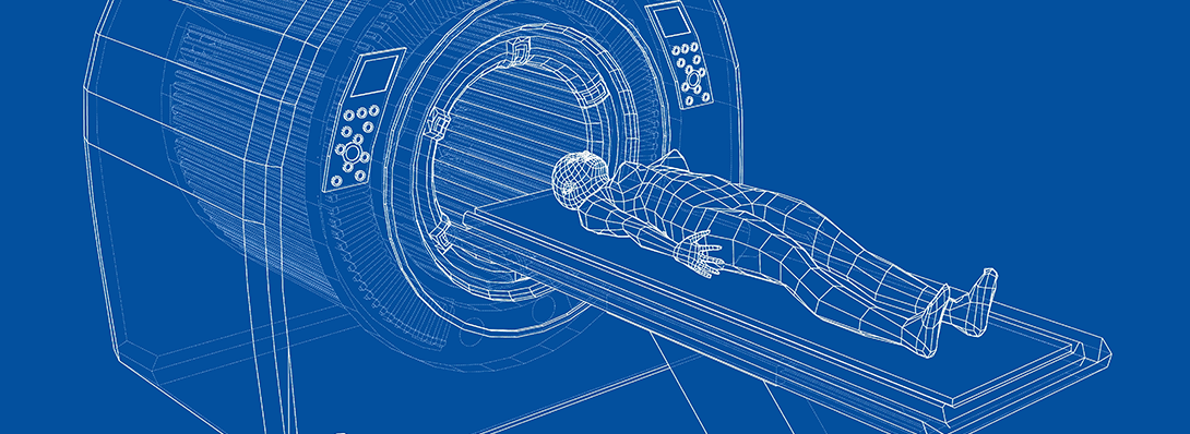 Stereotactic Body Radiotherapy (SBRT): Advancements in Precise and Targeted Cancer Treatment