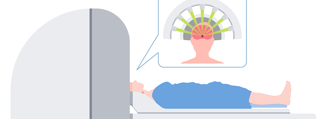 Understanding Radiosurgery or Stereotactic Radiosurgery for Precise Brain and Spine Treatment
