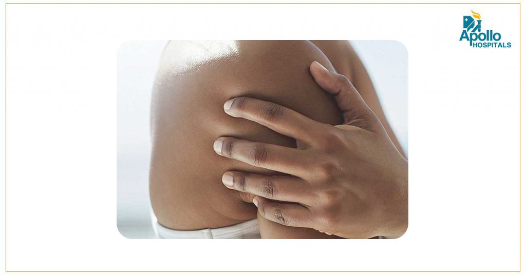 What are Bone Tumours?