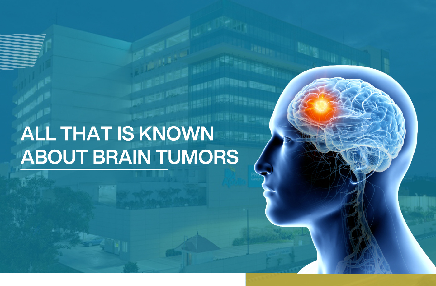 Brain Tumors vs. Cancers: What’s the Difference?